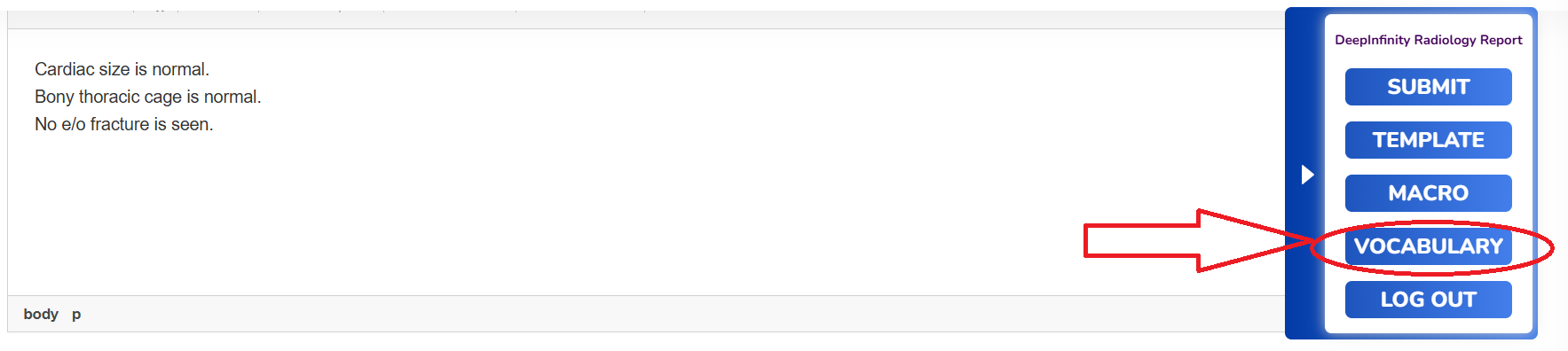 How to Add Vocabulary